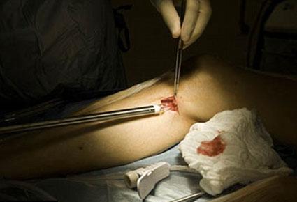 أول عملية قلب مفتوح مباشرة عبر موقع التويتر